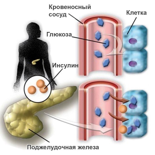 Lymphatic drainage massage of legs, thighs, abdomen with lymphedema, varicose veins, edema, varicose veins, pregnancy. Technique how to do it yourself