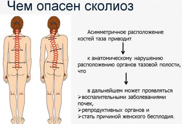 Esercizi di modellamento per dimagrire a casa. Video lezioni di fitness, esercizi per principianti, programma di allenamento