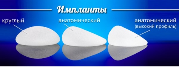 Breast enlargement. Cost in Moscow, St. Petersburg. Types of implants, prices