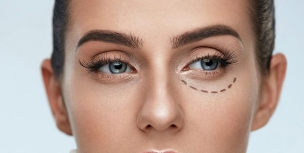 Blepharoplasty. Reviews of the operated. Pros and cons of plastic surgery, complications, rehabilitation. Laser, transconjunctival, circular, injection