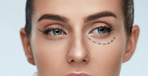 Laser blepharoplasty. Reviews of the operated lower, upper eyelids, how they do it. Prices