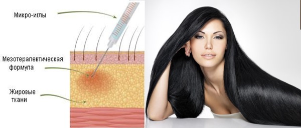 Mesotherapy of the scalp of the scalp. What is it, effect, price. How to do it at home