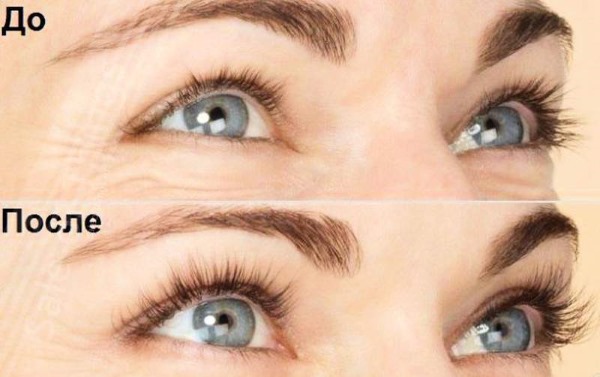 Nicotinic acid for eyebrows and eyelashes in ampoules. Application, how to use, photos, reviews