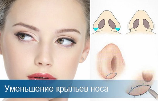 Rhinoplasty in Moscow. Prices and reviews for clinics in the capital