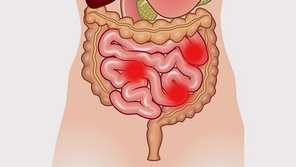 Fats on the face. From what appear, treatment in adults with medicines, folk remedies, ointment. How to get rid of at home