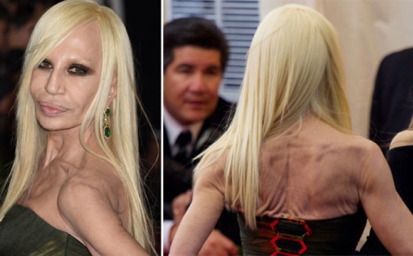 Donatella Versace before and after plastic surgery. Photo, height, weight, biography, age