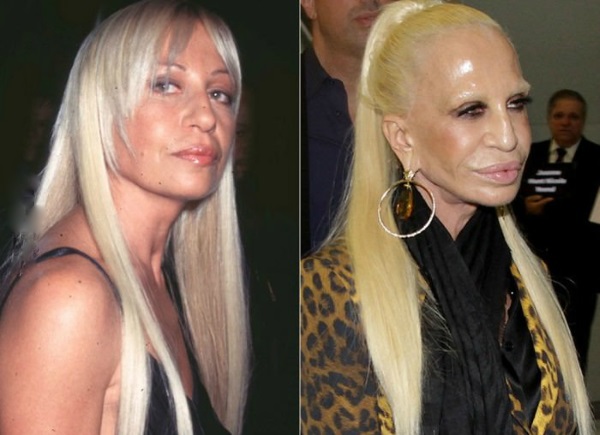 Donatella Versace prima e dopo la chirurgia plastica. Foto, altezza, peso, biografia, età