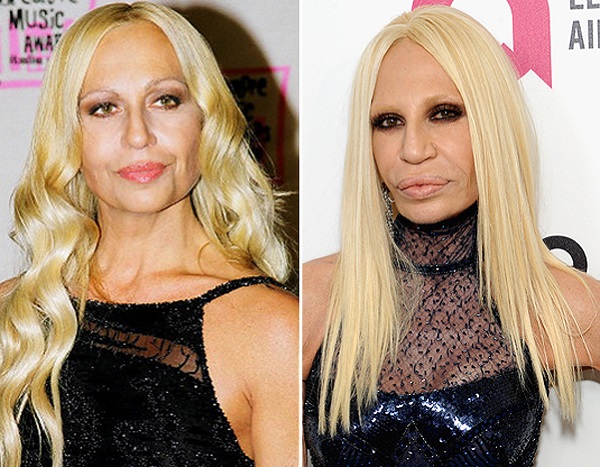 Donatella Versace prima e dopo la chirurgia plastica. Foto, altezza, peso, biografia, età