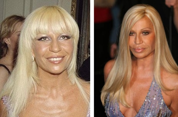 Donatella Versace before and after plastic surgery. Photo, height, weight, biography, age