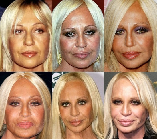 Donatella Versace before and after plastic surgery. Photo, height, weight, biography, age