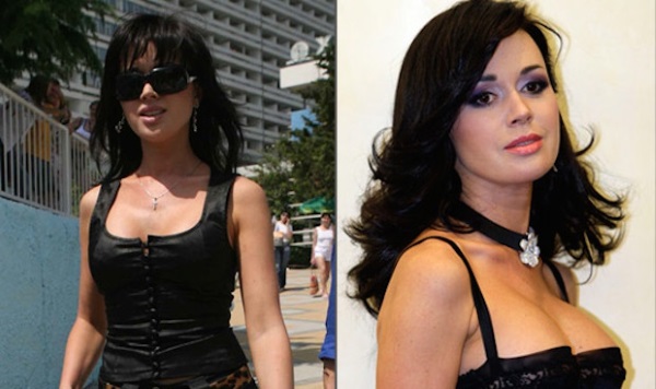 Russian actresses with big breasts before and after plastic surgery. A photo