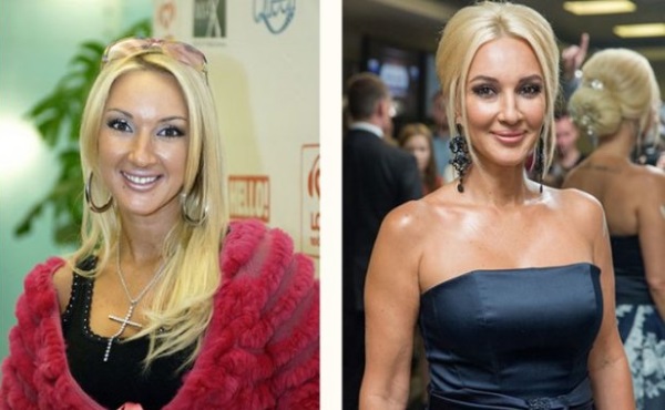 Russian actresses with big breasts before and after plastic surgery. A photo