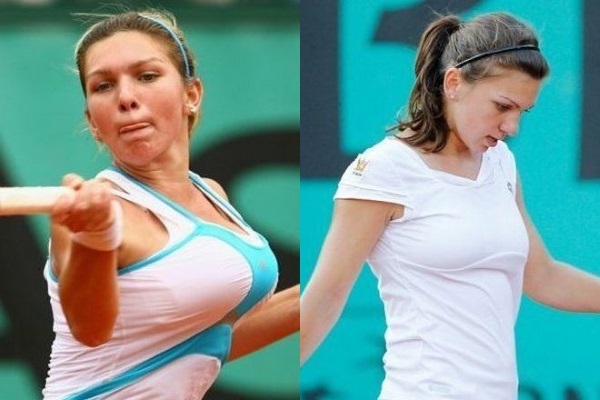 Simona Halep. Photos before and after surgery, weight and height of a tennis player