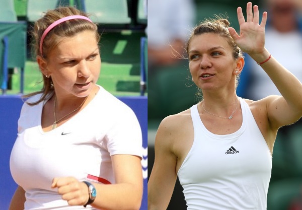 Simona Halep. Foto prima e dopo l'intervento chirurgico, peso e altezza di un tennista