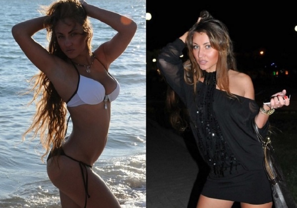 Victoria Bernikova before and after plastic surgery. Shape options