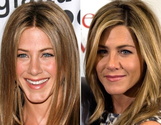 Jennifer Aniston. Foto prima e dopo la chirurgia plastica, in costume da bagno, i parametri della figura, l'aspetto dell'attrice