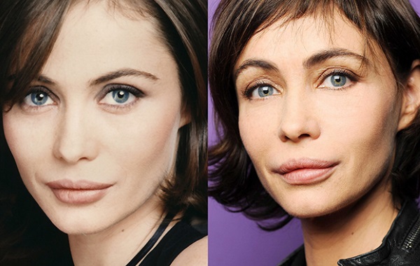 Emmanuelle Bear. Photos before and after plastic surgery, how the French actress has changed