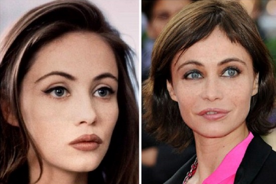 Emmanuelle Bear. Photos before and after plastic surgery, how the French actress has changed