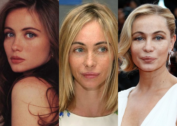 Emmanuelle Bear. Photos before and after plastic surgery, how the French actress has changed