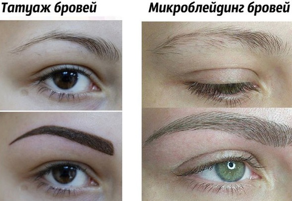 Microblading der Augenbrauen. Fotos vorher und nachher, was ist es, wie lange es dauert, wie es gemacht wird, der Preis