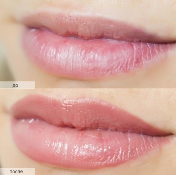 Permanent lip makeup with shading. Photos before and after the procedure, price