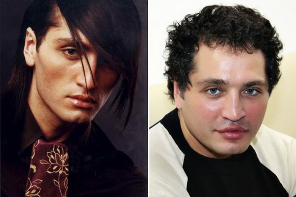 Rustam Solntsev before and after plastic surgery. Photo, what it looks like now