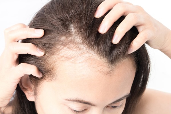 Scrubs for the scalp. Recipes for oily skin, dandruff, for hair growth and health