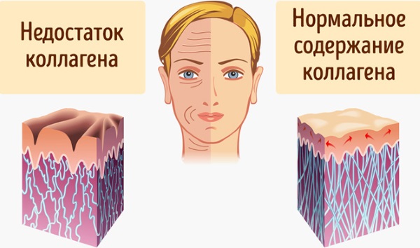 Injection facial contouring. What it is. Before and after photos, preparations, price