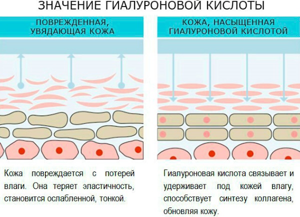 Injection facial contouring. What it is. Before and after photos, preparations, price