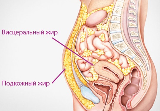 How to remove a big belly in women and men. Causes and remedies