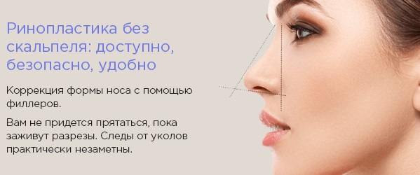 How to fix a woman's nose with potatoes. Rhinoplasty, photo before and after surgery, price