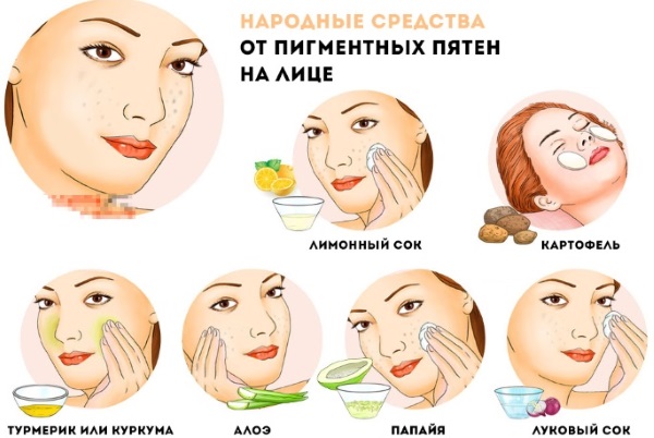 Whitening of the face. The best, quickest ways for stains, sunburn, masks, peels, home remedies