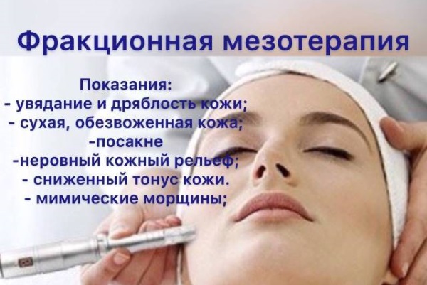 Fractional facial mesotherapy: indications, results, side effects, consequences. Reviews