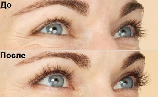 How to quickly grow eyelashes after extension. Folk recipes and pharmaceuticals