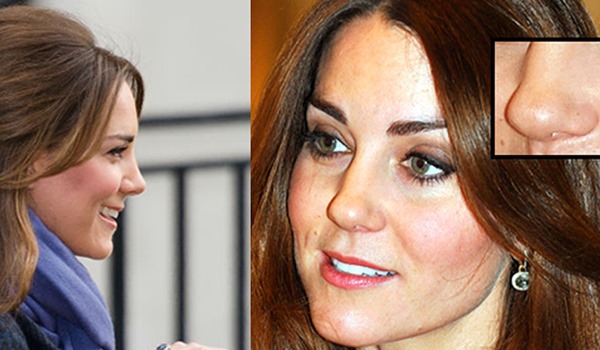 Kate Middleton. Photos in my youth, now, before and after plastic surgery, on the beach, frank. Biography and personal life