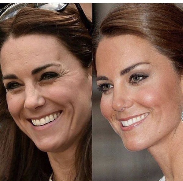 Kate Middleton. Photos in my youth, now, before and after plastic surgery, on the beach, frank. Biography and personal life