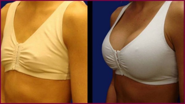 Breast enlargement operations. Price, before and after photos, types, indications, results