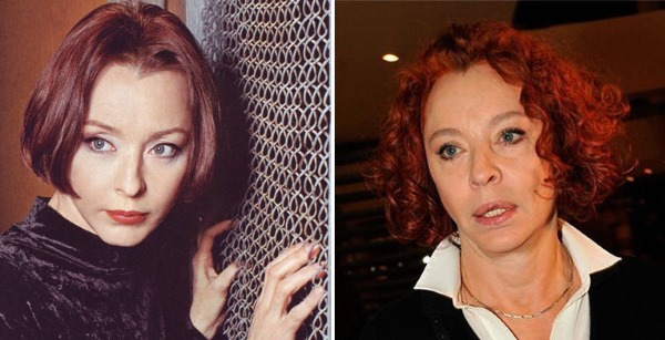 Russian actresses before and after plastic surgery. A photo