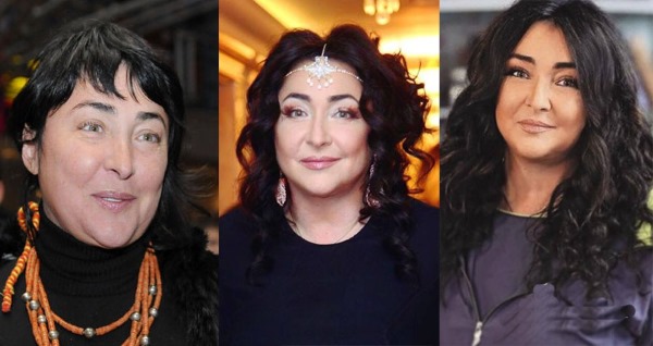 Russian actresses before and after plastic surgery. A photo