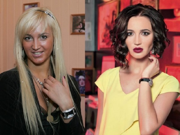 Russian actresses before and after plastic surgery. A photo