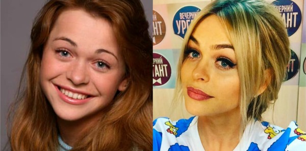 Russian actresses before and after plastic surgery. A photo