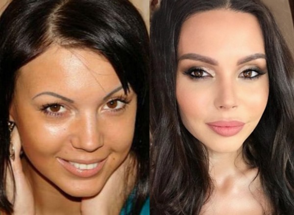 Russian actresses before and after plastic surgery. A photo