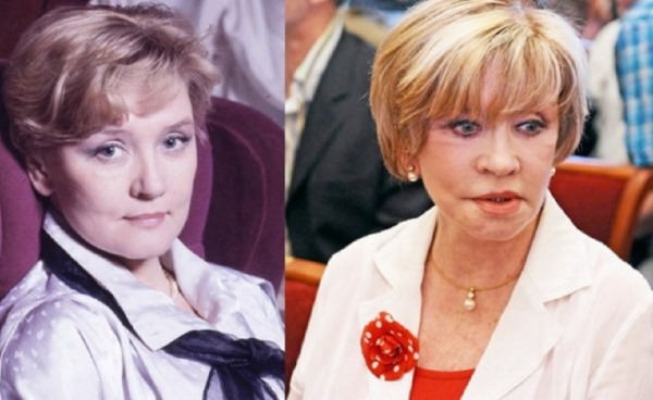 Russian actresses before and after plastic surgery. A photo