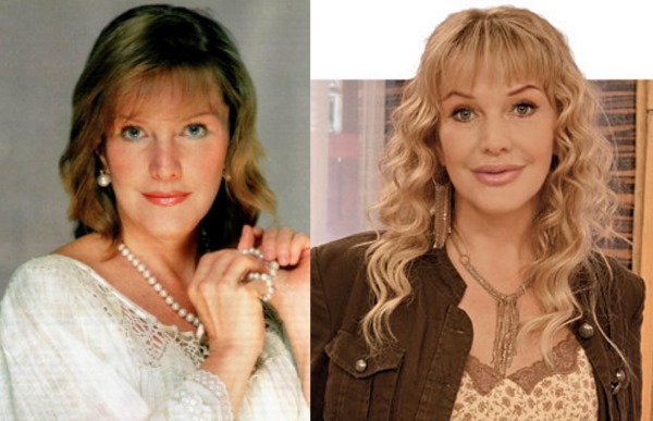 Russian actresses before and after plastic surgery. A photo