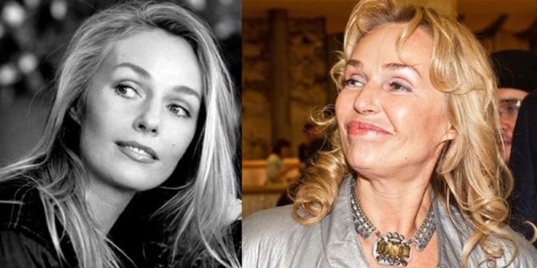 Russian actresses before and after plastic surgery. A photo