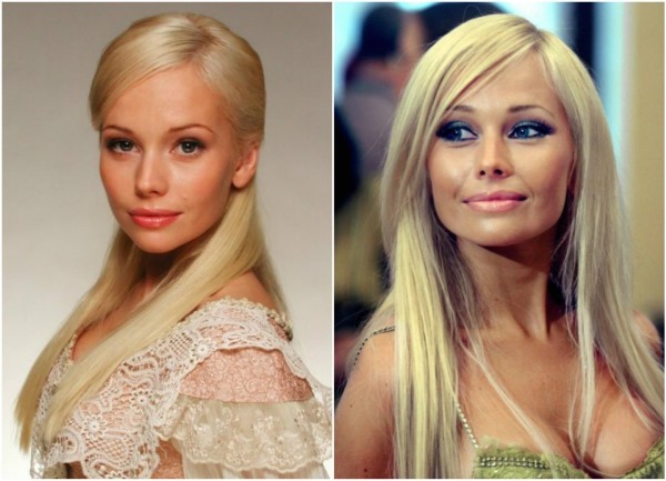 Russian actresses before and after plastic surgery. A photo