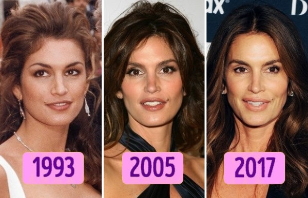 Cindy Crawford. Photos now, in youth, changes before and after plastic surgery