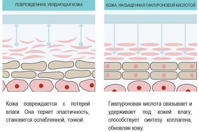 Contouring of the nose, cheekbones, lips, chin, nasolabial folds. How is it done, price, reviews