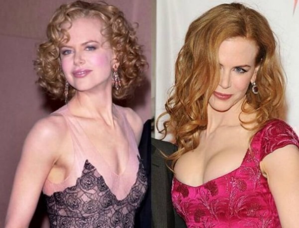 Hollywood actresses. Photos with names, the most beautiful blondes, brunettes, redheads. What plastic surgery did