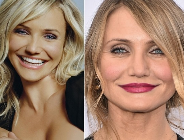 Hollywood actresses. Photos with names, the most beautiful blondes, brunettes, redheads. What plastic surgery did